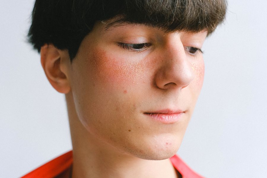 hombre joven pecas fototipo 2 Hombre joven con pecas para fototipo